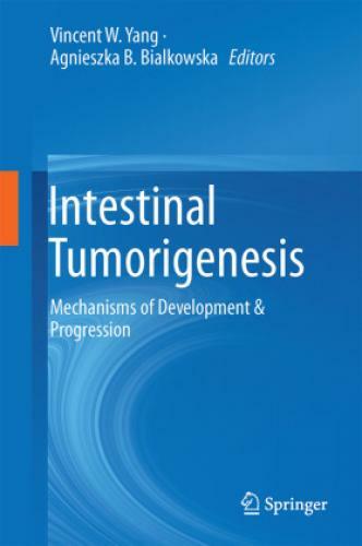 Thumbnail - Intestinal Tumorigenesis Mechanisms Of Development & Progression 2926