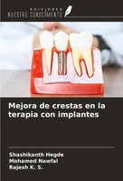 Mejora De Crestas En La Terapia Con Implantes Shashikanth Hegde (U. A.) Buch
