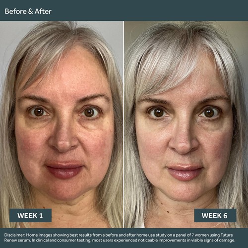 No7 Future Renew Holiday Gift Set Serum and Night Cream for Sun Damage Repair - Picture 4 of 9