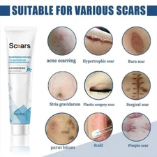 Scar Removal Cream Treatment  Stretch Marks Burns Scald Repair Hyperplasia Cesar