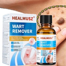 Wart Remover Liquid Skin Tag Mole Remover Eliminate Feet Corn Wart Remove Liquid