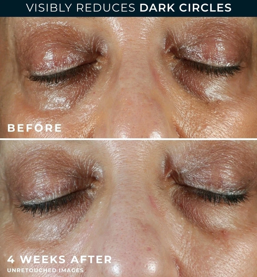 TWO BOXES RoC Multi Correxion Even Tone + Lift Eye Cream - 0.5 FL OZ 15ml - Image 4 of 4