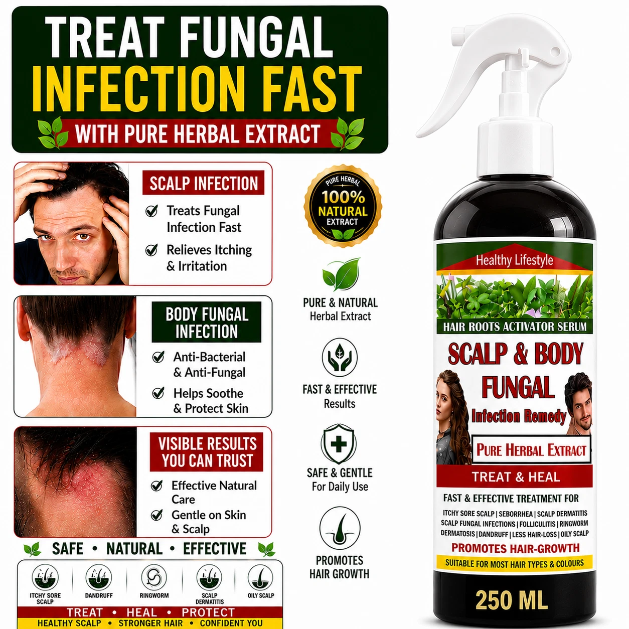 Scalp Fungal Infection Relief Hair Strength Growth Booster Herbal Scalp Disease