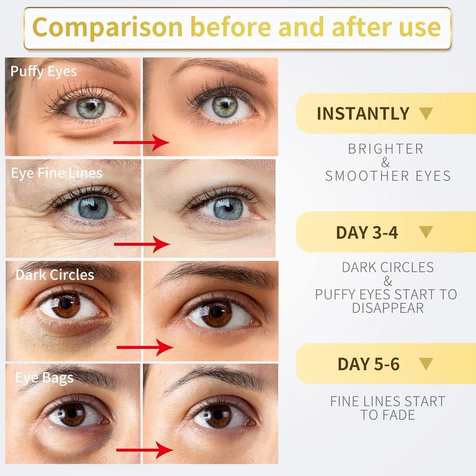 Under Eye Patches for Dark Circles and Puffiness Wrinkles for Self Care - Image 3 of 4