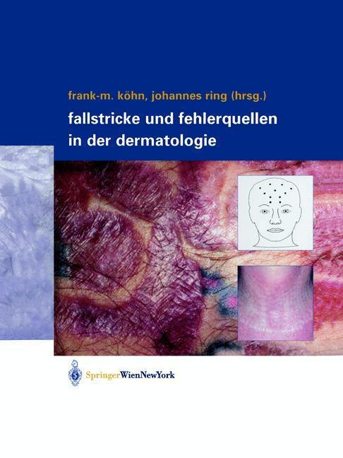 Thumbnail - Fallstricke Und Fehlerquellen In Der Dermatologie | Buch |