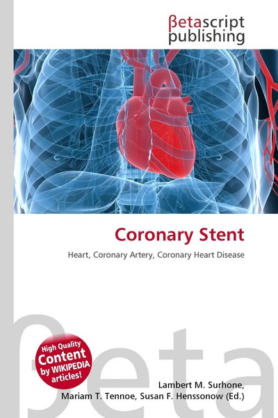 Lambert M. Surhone (U. A.) | Coronary Stent | Taschenbuch | Englisch (2026)-image