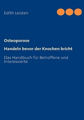 Osteoporose: Handeln bevor der Knochen bricht by Edith Leisten (German) Paperbac