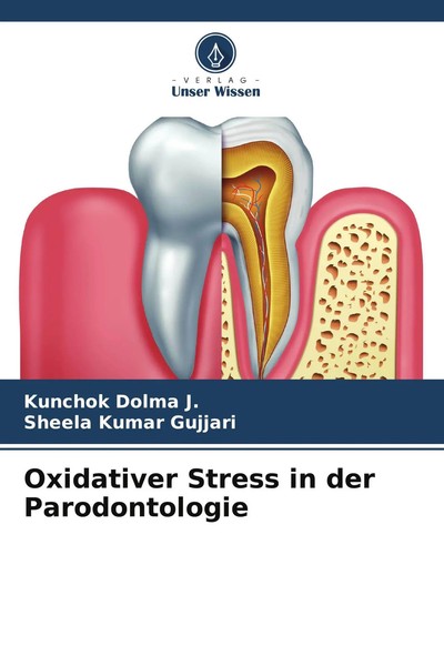 Kunchok Dolma J. (U. A.) | Oxidativer Stress In Der Parodontologie | Taschenbuch-image