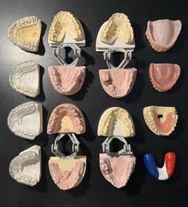 12 DENTAL DEMONSTRATION MODELS IMPLANTS DENTURES RETAINERS ETC. SEE IMAGES 