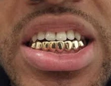 14K Gold 5X Electroplated Mouth 8 Tooth Grills Grillz 8 Bottom Lower + Mold Kit