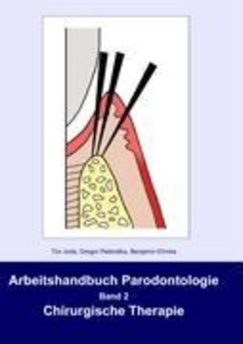 Thumbnail - Arbeitshandbuch Parodontologie | Band 2 Chirurgische Therapie | Tim
