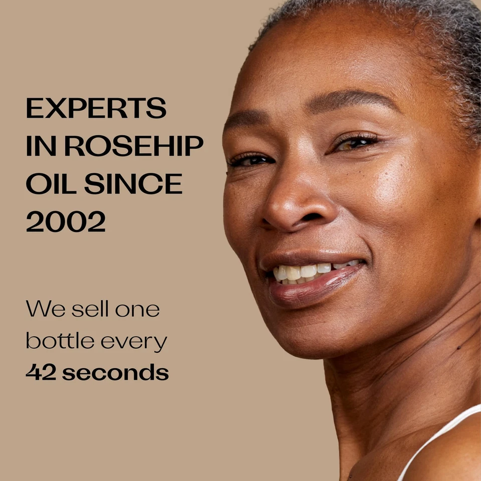 认证有机玫瑰果油,强效营养,改善... — 第 3/4 张图片