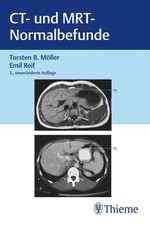 CT und MRT Normalbefunde Torsten Bert Möller