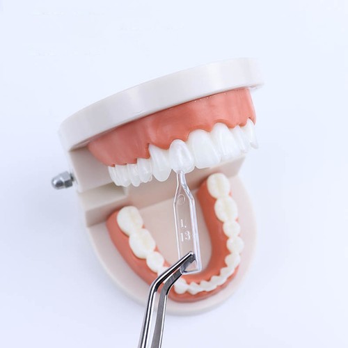 Molde de carillas dentales resina compuesta anterior posterior dientes molar restauración - Imagen 14 de 36