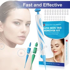 Natural Painless Auto SKIN TAG Removal Kit Skin Tag Bands Remover Device Auto