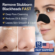 10PCS Blackhead Nose Strips Deep Cleansing Pore Remover Oil Control