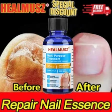 HEALMUSZ Multi-Purpose Treatment for Toenail & Fingernails Repair Solution 30ml