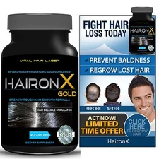 Hair Growth Vitamins Hair Loss Treatment for Faster Growth Full hair by HaironX