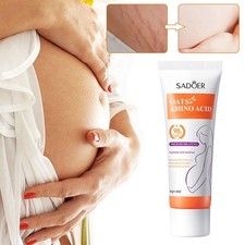 40g Scar Removal Cream For Old-Scars Stre tch Mark Removal CreaUS Rapid K8G3