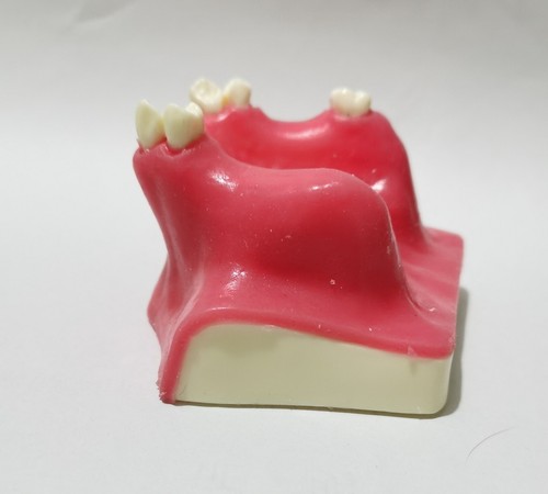 Dental Implant Maxillary Sinus Lift model Resin material Typodont Teeth - Picture 15 of 16