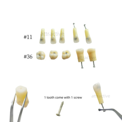 Dental Molar/Front Vitro Teeth Decay Caries Tooth Model Dentist Student Practise