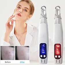 Handheld Red/Blue Light Laser Tattoo Removal Pen Skin Care Dark Spot Remover