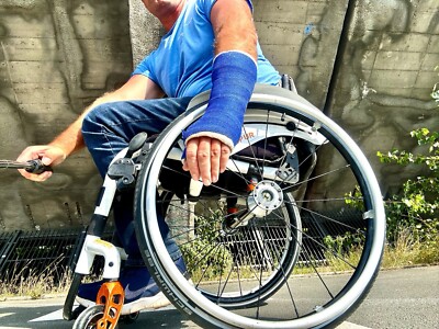 Gipsarm SATS links Kunststoffgips schwarz