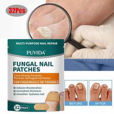 32 Patches Toenail Fungus Treatment Fungal Nail Patches Nail Repair Nail Care