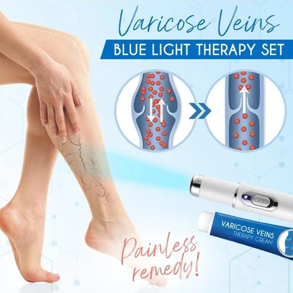 Red Light Therapy For Spider Veins Shelly Lighting