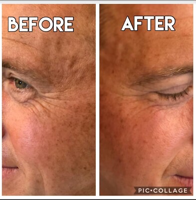 Nuskin ageLOC Galvanic Spa Facial Gels for Anti-Ageing Device Set