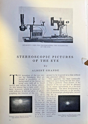 1911 Dr. W. Thorner Stereoscopic Pictures of the Eye illustrated