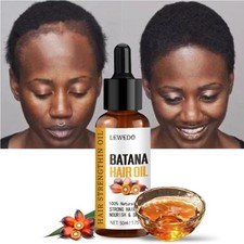 Batana Oil Serum for Hair Growth, Batana Oil Essence, Repair Damaged Hair  US