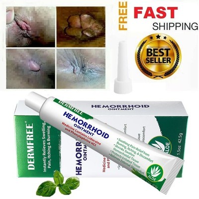 Haemorrhoids Remove Ointment Herbal Cream Relief Piles Pain Reduce Itching SALE