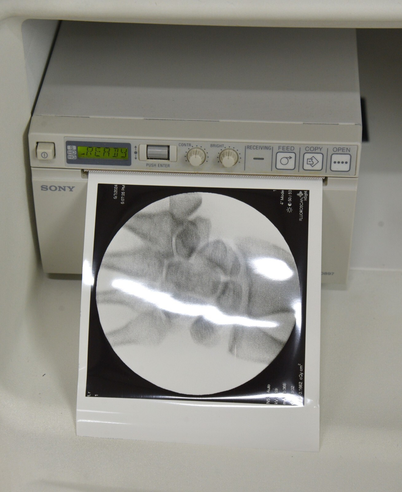 2011 Hologic Fluoroscan InSight 2 C-Arm Imaging System w/Wireless Footswitch