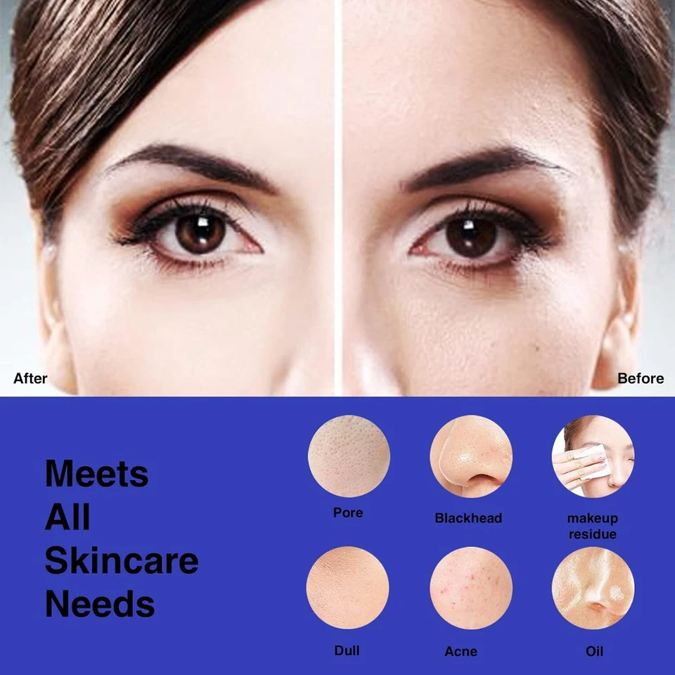 NågraCola CLIE Escova de Limpeza Facial Sônica Impermeável Elétrica Limpeza Facial... - Imagem 4 de 4