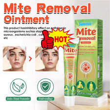 20g Mite Removal Ointment Mite and Lice Care Cream Hot New  