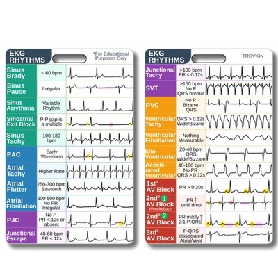 EKG Rhythm Interpretation Badge Card Nursing Telemetry Reference Guide