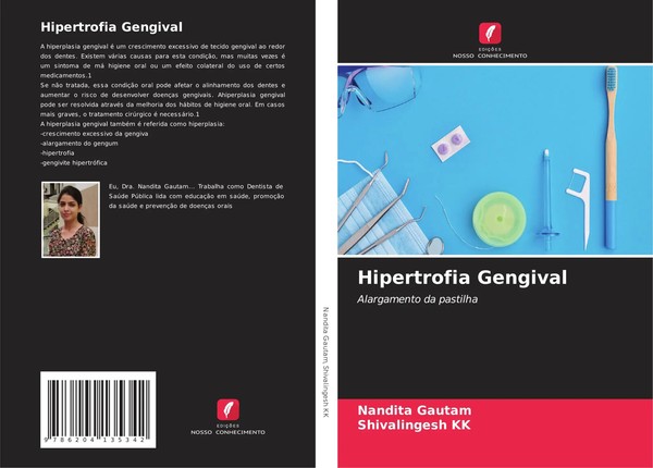 Nandita Gautam (U. A.) | Hipertrofia Gengival | Taschenbuch | Portugiesisch-image