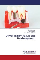 Samruddhi Patil (U. A.) | Dental Implant Failure And Its Management | Buch