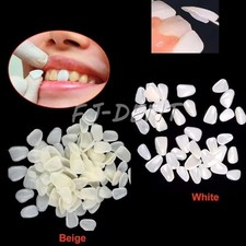 70pcs Dental Resin Veneers Upper Lower Anterior Teeth Whitening Kit A1 A2