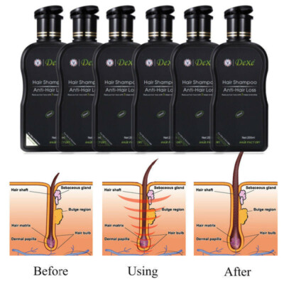 Hair Growth Shampoo Hair Regrowth Treatment Anti-Hair Loss Shampoo For Men Women