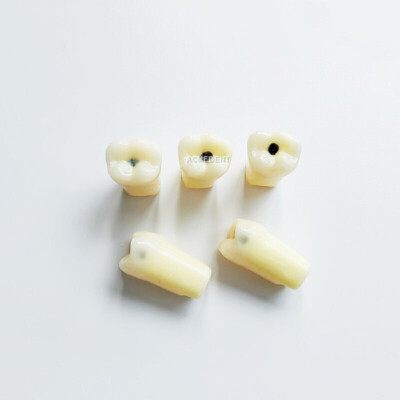 Dental Molar Vitro Teeth Decay Caries Screw Model Dentist Dental School Student