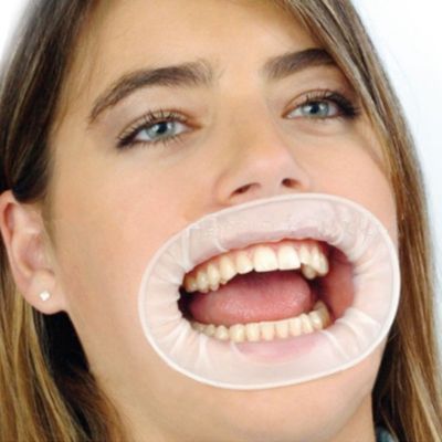 Lot De 10 écarteurs Buccaux En Caoutchouc Pour Dentiste – Ouverture De Bouche – Neuf