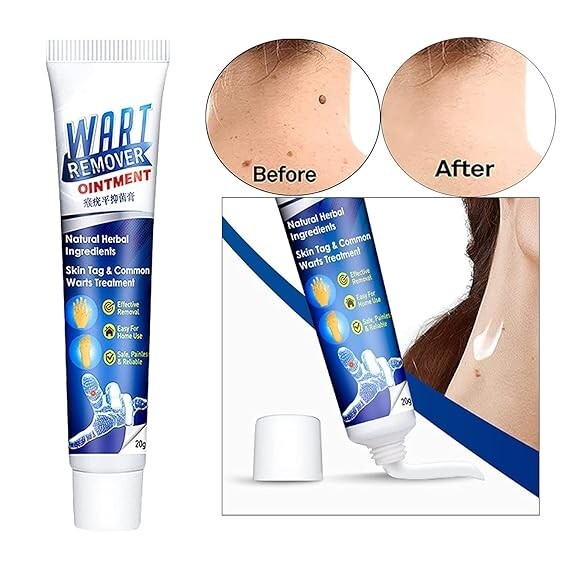 Crème Pour Verrues - Traitement Naturel Verrues Plates Et Génitales - 20g - Taille Voyage - Ingrédients Naturels