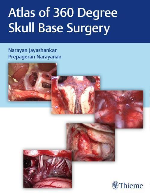 Thumbnail - Atlas Of 360 Degree Skull Base Surgery Narayan Jayashankar