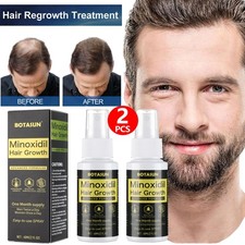 2X Minoxidil 5% Hair Regrowth Treatment Topical Solution for Men 2 Months Supply