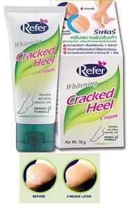 cracked heels cream
