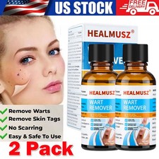 2PCS Wart Remover Liquid Skin Tag Mole Remover Eliminate Foot Corn Warts Unisex