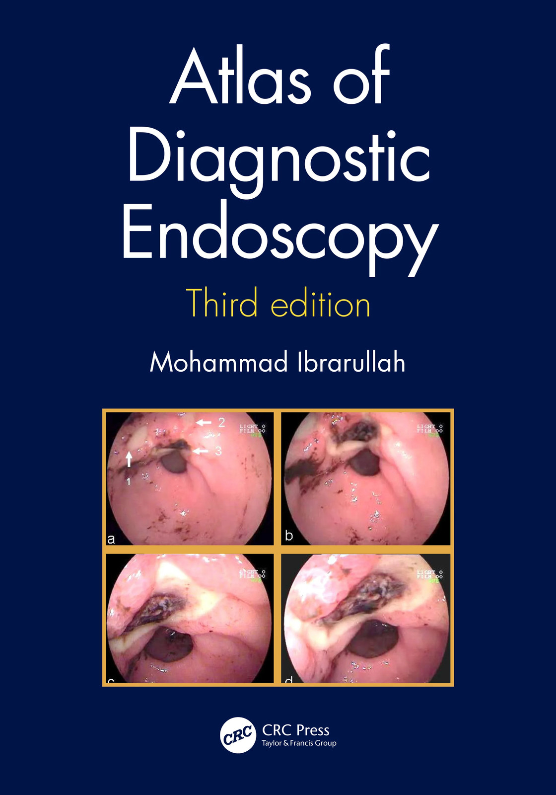 Atlas of Diagnostic Endoscopy, 3E - 3rd Edition
