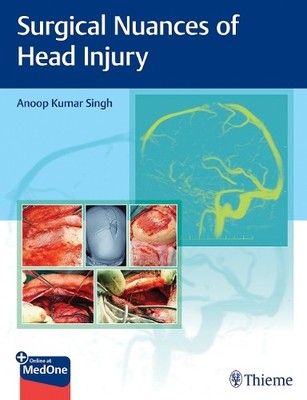 Surgical Nuances of Head Injury - 9789395390248